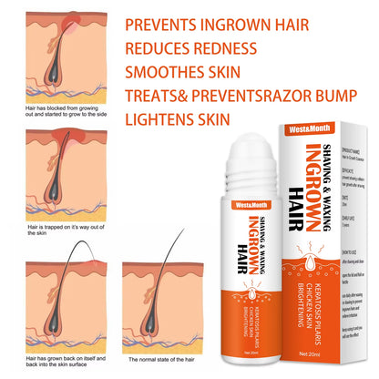 Ingrown Hairs Treatment after Shave Repair Serum Solution Dark Spot Reduce Redness for Vanish Pfb Skin Care Prevent Razor Bumps