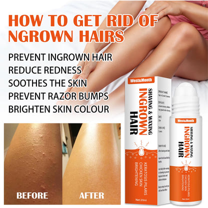 Ingrown Hairs Treatment after Shave Repair Serum Solution Dark Spot Reduce Redness for Vanish Pfb Skin Care Prevent Razor Bumps