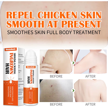 Ingrown Hairs Treatment after Shave Repair Serum Solution Dark Spot Reduce Redness for Vanish Pfb Skin Care Prevent Razor Bumps